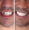 *Limited Supply-THE AMAZING PERFECT SMILE*
